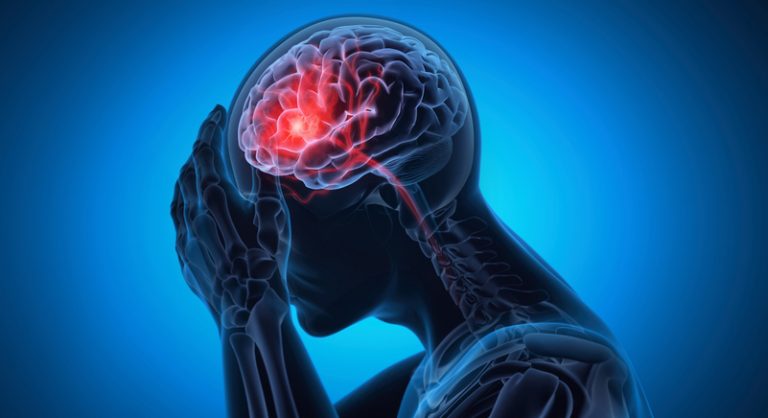 Richmond Traumatic Brain Injury Lawyer: Navigating Workplace Accidents and Legal Recourse